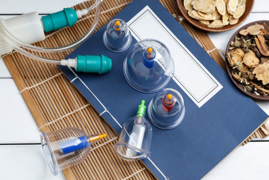 Hijama (Cupping Therapy) – The Sunnah Way to Detox, Heal, and Revive